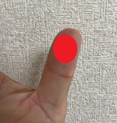 ゴルフ｜右手の親指の皮むけって大丈夫？スイングが悪い結果？
